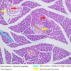 Glândula Alveolar Composta - Pâncreas 10x